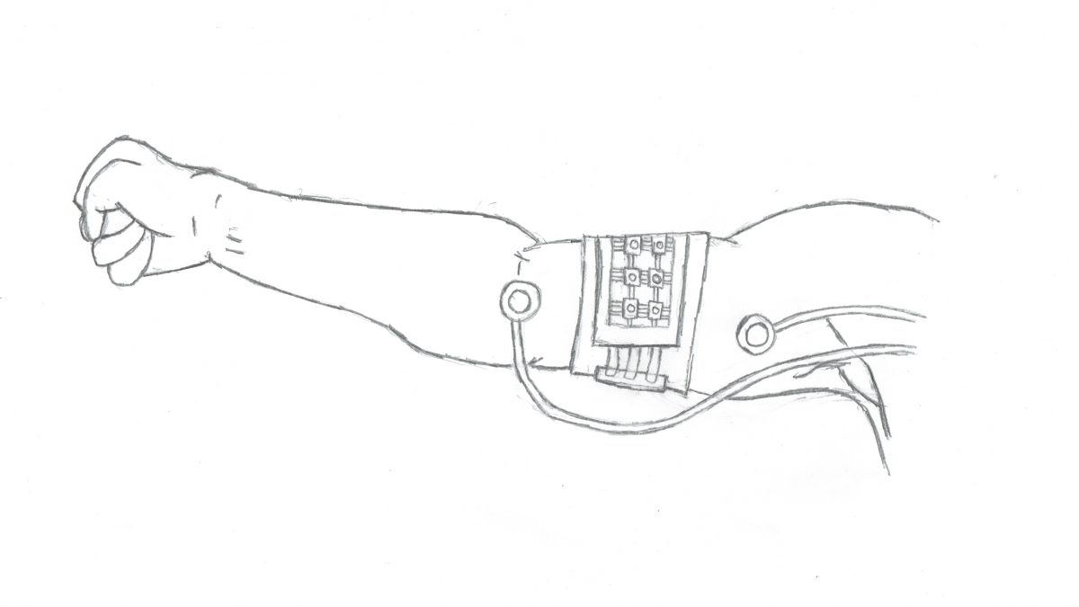 Biomed students make tech for people with disabilities – The Eyeopener